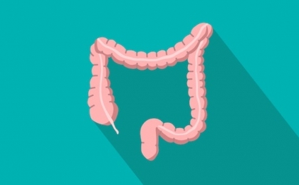 Colorectal Cancers